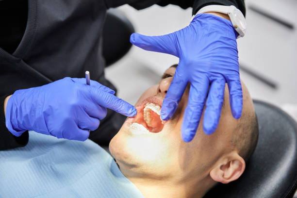 Best Emergency Dentist for Lost Fillings or Crowns in Bellemont, AZ